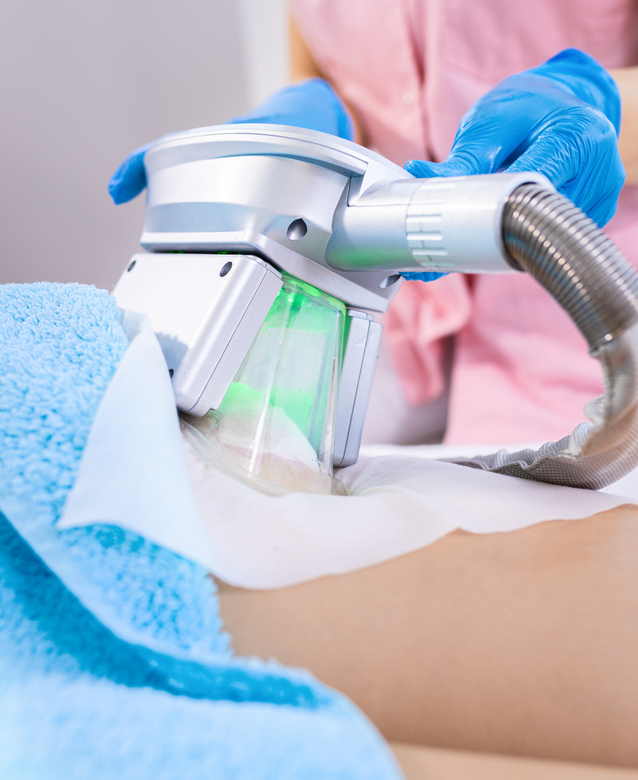 Cryolipolyse au centre de bien-être
