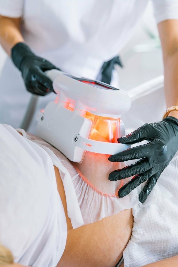 Séance de cryolipolyse sur la cuisse