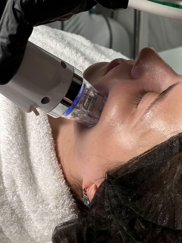 Séance de Fusion Plasma Froid sur le visage